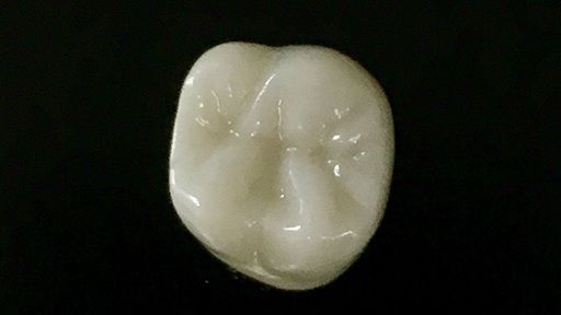 White dental crown against black background