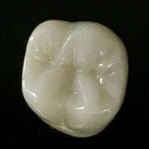 Close up of white dental crown