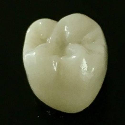 White dental crown against black background