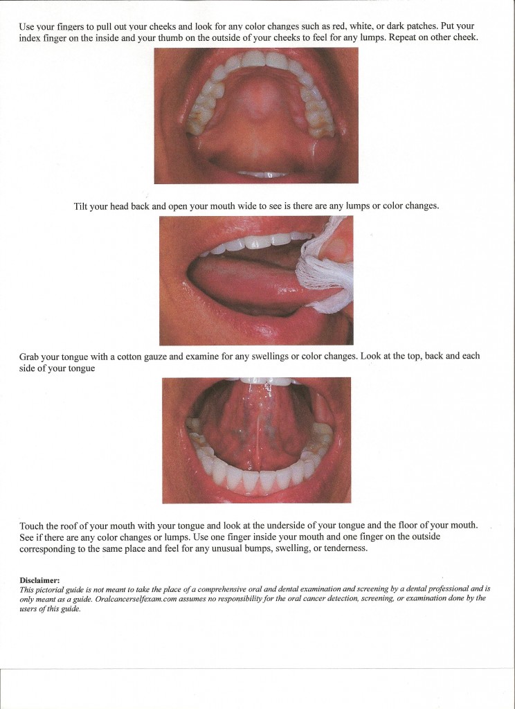 Prostate Cancer Signs