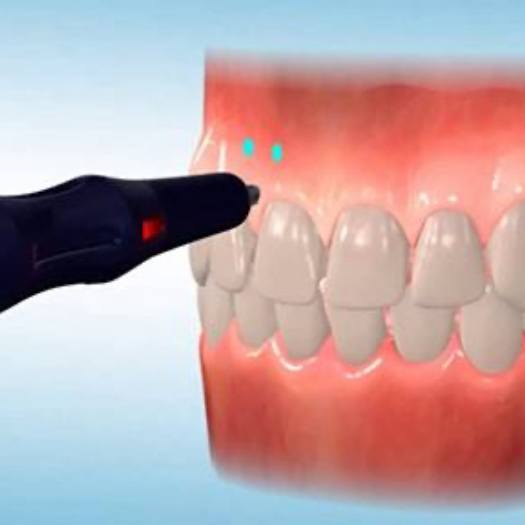 Animation of Propel process