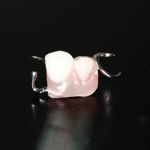 Porcelain dental bridge