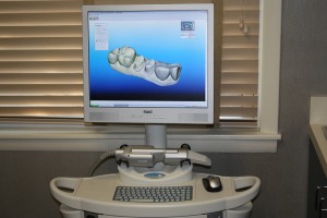 iTero digital oral scanner at McCarl Dental Group