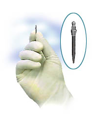 Hand holding a dental implant