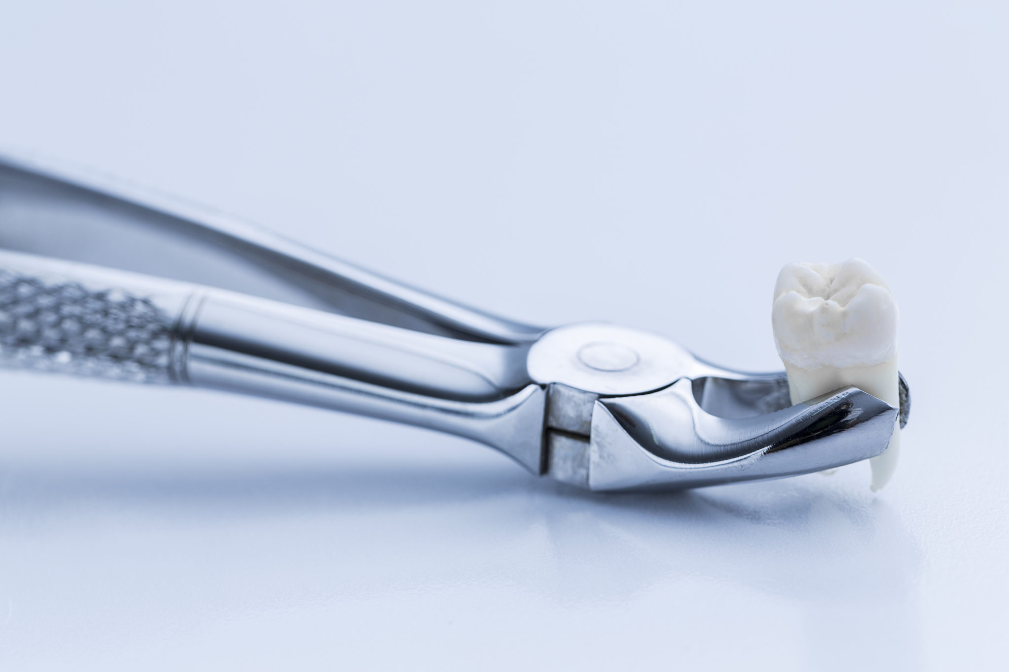 Tooth extraction. Хирургическая стоматология. Хирургическая стоматология зубов.